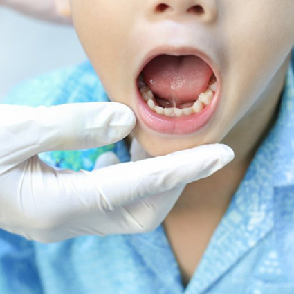 Dentist examining a child’s mouth