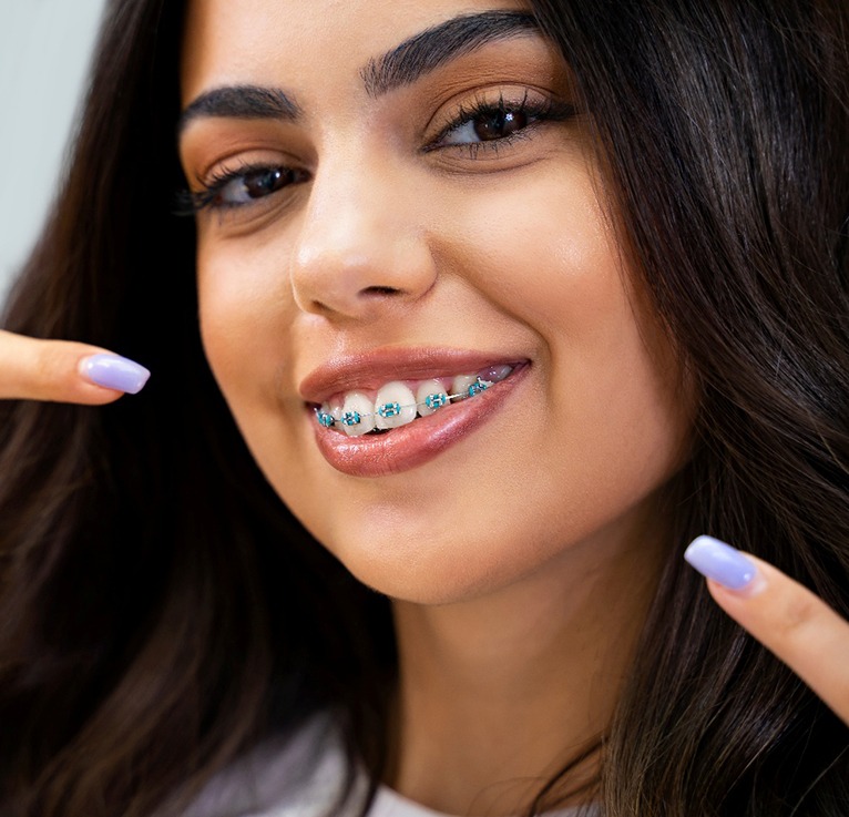 A teenage girl with traditional braces